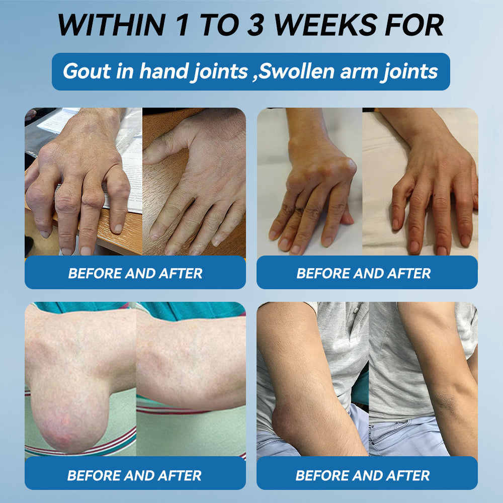 | 𝐋𝐚𝐬𝐭 𝐃𝐚𝐲 𝐏𝐫𝐨𝐦𝐨𝐭𝐢𝐨𝐧 𝟖𝟎% 𝐎𝐅𝐅 |   🇬🇧 𝐂𝐫𝐨𝐚𝐢𝐞® 𝐁𝐏𝐂-𝟏𝟓𝟕 𝐉𝐨𝐢𝐧𝐭 𝐇𝐞𝐚𝐥𝐢𝐧𝐠 𝐂𝐫𝐞𝐚𝐦 - Treats Arthritis, Neuropathy, Rheumatism, Sports Injuries & More🏆