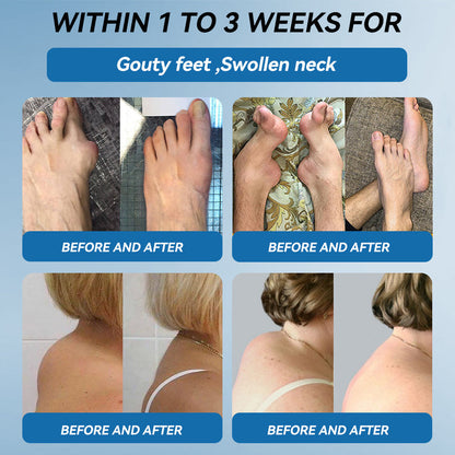 | 𝐋𝐚𝐬𝐭 𝐃𝐚𝐲 𝐏𝐫𝐨𝐦𝐨𝐭𝐢𝐨𝐧 𝟖𝟎% 𝐎𝐅𝐅 |   🇬🇧 𝐂𝐫𝐨𝐚𝐢𝐞® 𝐁𝐏𝐂-𝟏𝟓𝟕 𝐉𝐨𝐢𝐧𝐭 𝐇𝐞𝐚𝐥𝐢𝐧𝐠 𝐂𝐫𝐞𝐚𝐦 - Treats Arthritis, Neuropathy, Rheumatism, Sports Injuries & More🏆