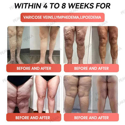 | 𝐋𝐚𝐬𝐭 𝐃𝐚𝐲 𝐏𝐫𝐨𝐦𝐨𝐭𝐢𝐨𝐧 8𝟎% 𝐎𝐅𝐅 | 🇬🇧 PEAKA® GLP-1 Natural Happy Estrogen Balance · Double-Layer Nanoliposome Microcapsules ·Easy-to-Swallow for Middle-Aged & Older Adults💪For obesity, diabetes, menopause relief, sleep, gut & joints)